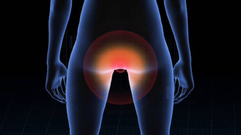 Internal vs. External Hemorrhoids What’s the Difference