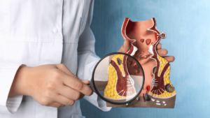 Difference Between Hemorrhoids & Anal Fissures