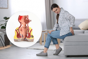 Can Untreated Internal Hemorrhoids Disappear?