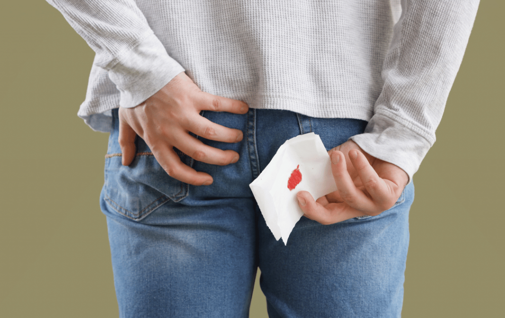 What Happens When Hemorrhoids Are Left Untreated