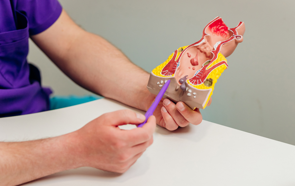What type of doctor treats hemorrhoids?