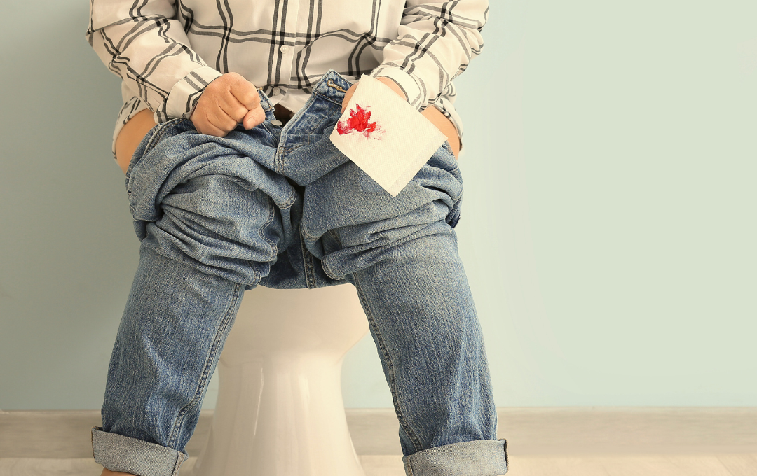 How to tell the difference between hemorrhoids and colorectal cancer