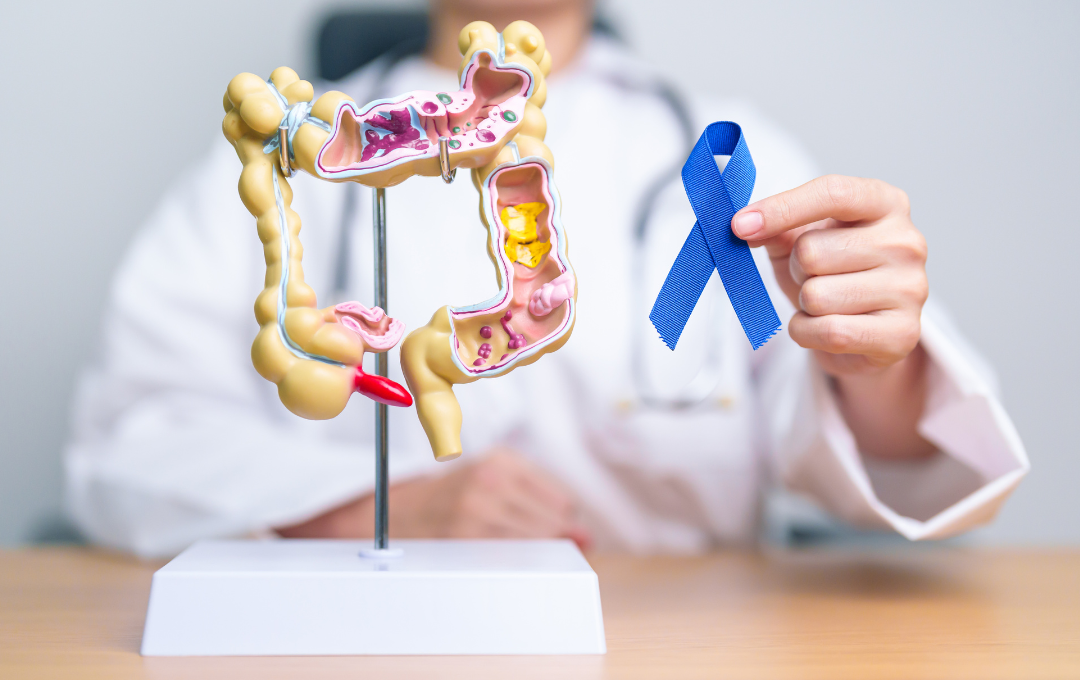 Colorectal Cancer Awareness Month emphasizes that early detection and treatment improves survival rate