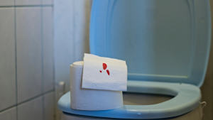 When to See a Doctor for Hemorrhoids 