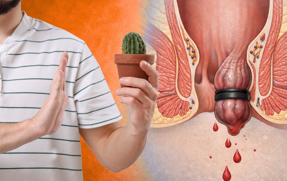 Rubber Band Ligation Disadvantages?