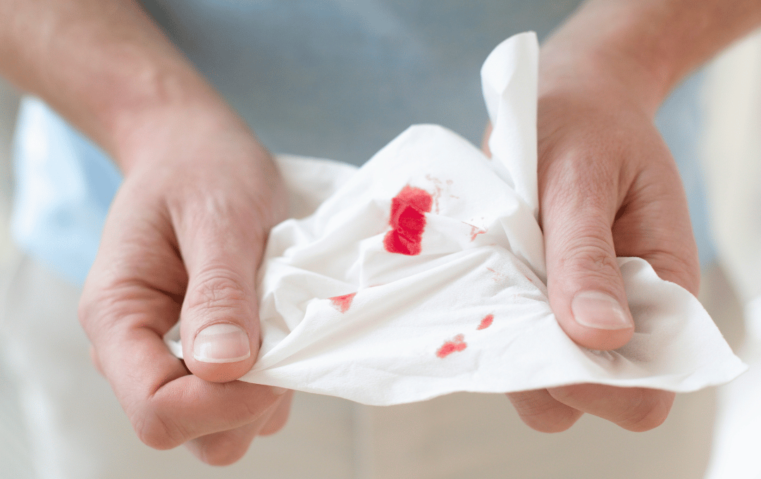 Bloody toilet paper from bleeding hemorrhoids.